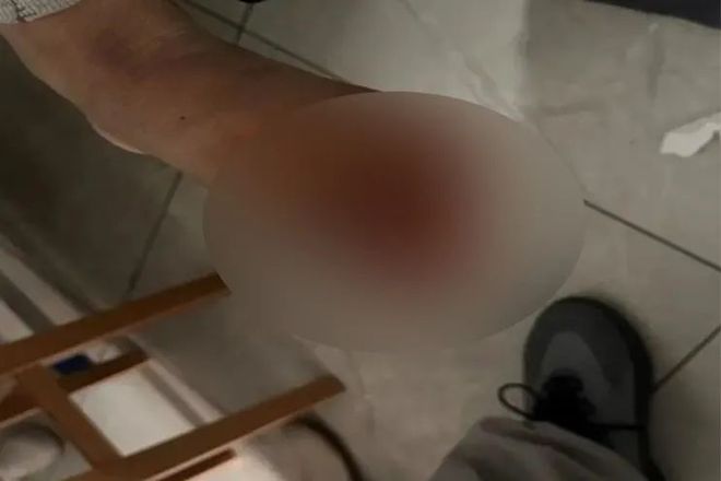 男子癌症晚期、全身恶臭……上海专家拒绝手术但最后被他说动了